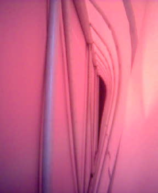 Billede6